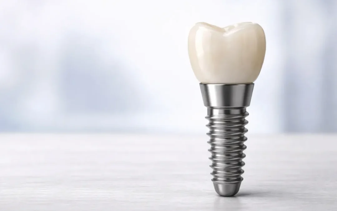 Dental implants abroad in Spain: why patients choose Fuerteventura